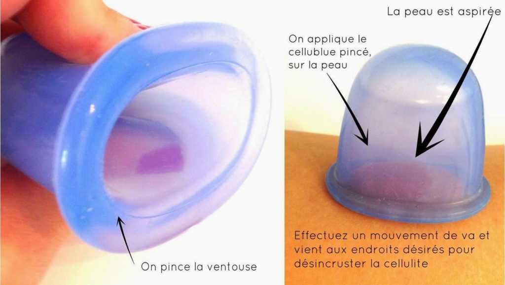 comment utiliser la ventouse anti cellulite