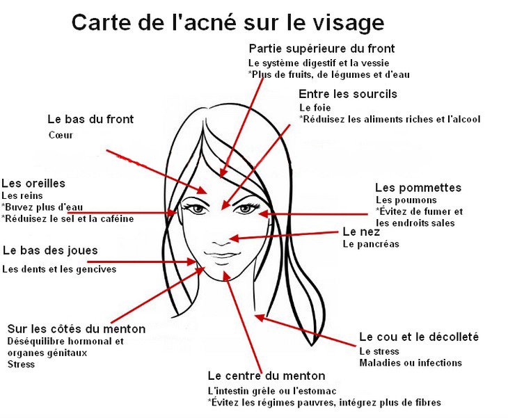acné