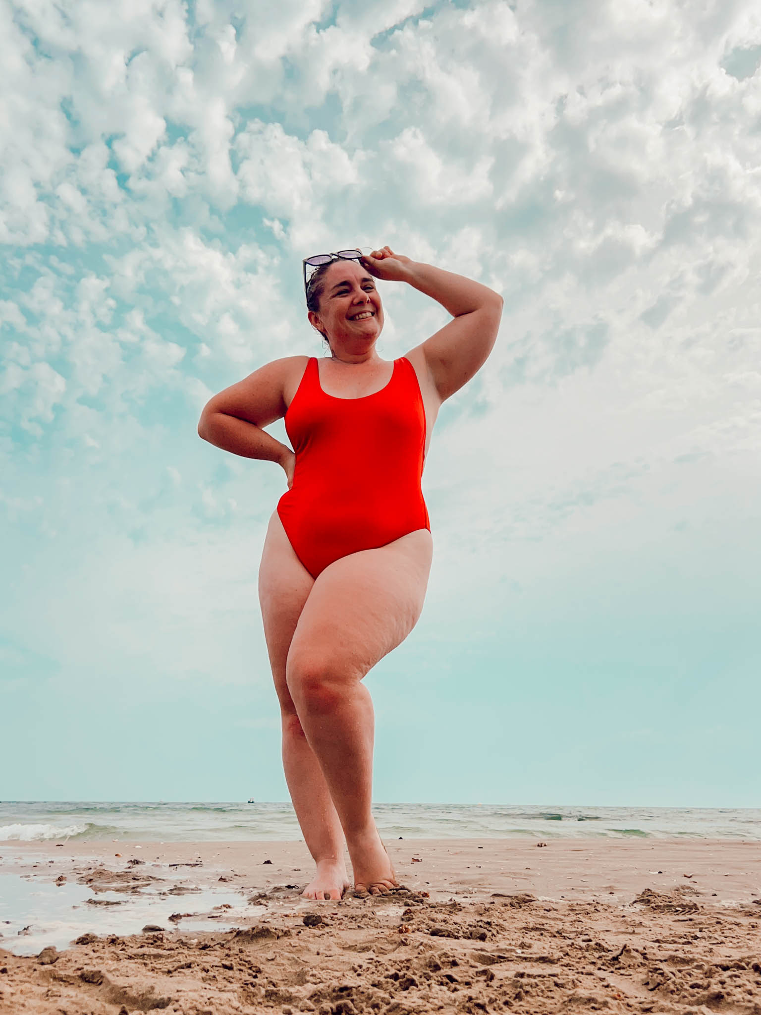 Le lipoedème est une maladie chronique qui provoque une accumulation anormale et symétrique de graisse, le plus souvent sur les jambes et parfois les bras, sans toucher les mains ni les pieds. Contrairement à une prise de poids classique, cette graisse est douloureuse, résistante aux régimes et influencée par les hormones, en particulier lors de la puberté, de la grossesse ou de la ménopause. Souvent confondu avec de l’obésité ou de la cellulite, le lipœdème est pourtant une pathologie à part entière qui nécessite un diagnostic et une prise en charge adaptés.