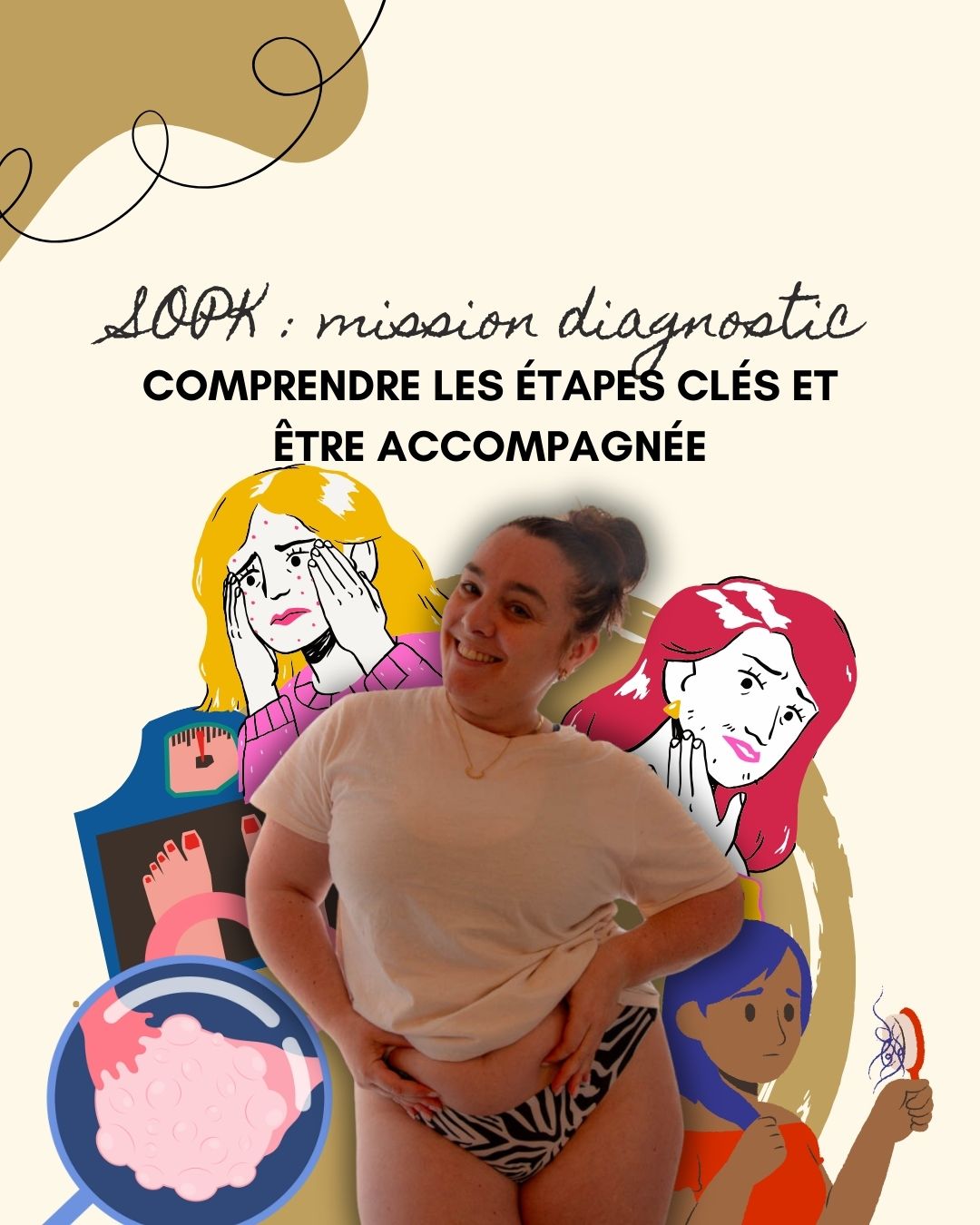 Le syndrome des ovaires polykystiques (SOPK) est un trouble hormonal fréquent chez les femmes en âge de procréer, caractérisé par des cycles irréguliers, un excès d’androgènes et parfois des ovaires polykystiques. Il s’accompagne souvent de symptômes métaboliques comme la résistance à l’insuline, la prise de poids abdominale et une inflammation de bas grade. Bien que chronique, le SOPK peut être efficacement pris en charge grâce à une combinaison de suivi médical, adaptations alimentaires, activité physique et, si nécessaire, traitements médicamenteux ou compléments.