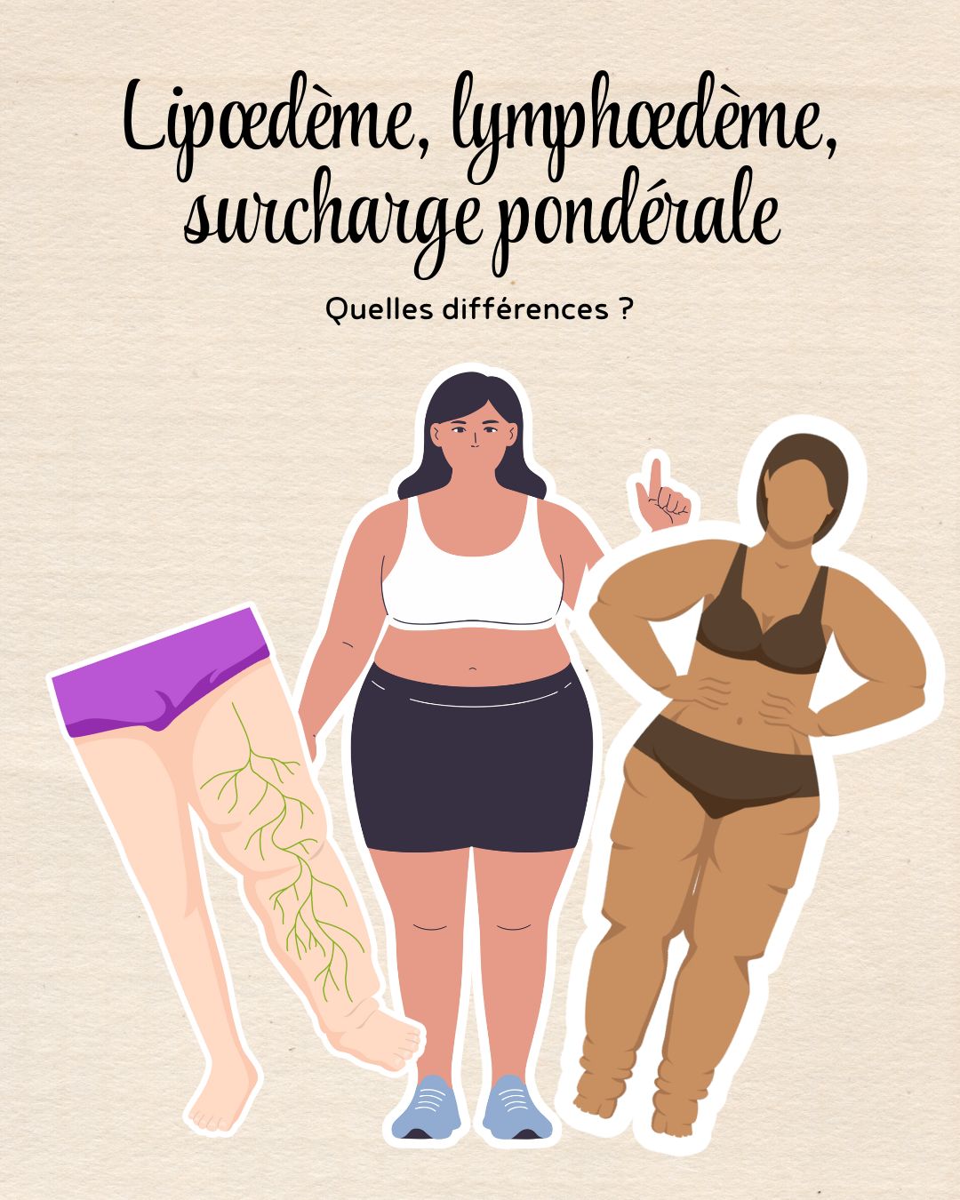 Il est tout à fait normal de confondre lipœdème, lymphœdème et surcharge pondérale, d’autant que leurs symptômes peuvent se ressembler au premier coup d’œil. Et tu sais quoi ? Même certains professionnels de santé passent parfois à côté ou posent un diagnostic approximatif, simplement parce que ces pathologies restent encore mal connues ou peu abordées dans les formations. Résultat : beaucoup de femmes se sentent incomprises… alors qu’en réalité, elles ont juste besoin d’être orientées vers les bons spécialistes.