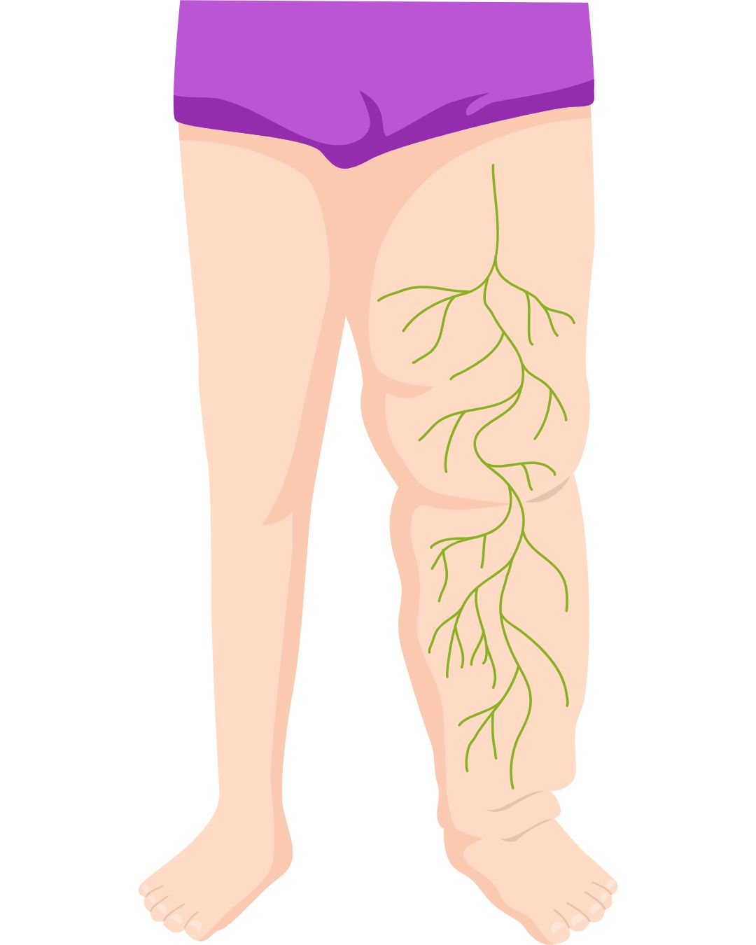 Il est tout à fait normal de confondre lipœdème, lymphœdème et surcharge pondérale, d’autant que leurs symptômes peuvent se ressembler au premier coup d’œil. Et tu sais quoi ? Même certains professionnels de santé passent parfois à côté ou posent un diagnostic approximatif, simplement parce que ces pathologies restent encore mal connues ou peu abordées dans les formations. Résultat : beaucoup de femmes se sentent incomprises… alors qu’en réalité, elles ont juste besoin d’être orientées vers les bons spécialistes.