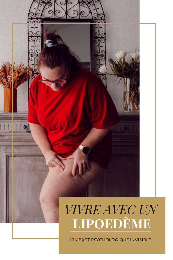 La souffrance psychologique du lipœdème est encore trop peu reconnue, alors qu’elle impacte profondément l’estime de soi, l’image corporelle et la santé mentale des femmes concernées. Entre perte de contrôle du corps, culpabilité liée à la confusion avec l’obésité et charge mentale d’une maladie chronique, le lipoedème ne touche pas uniquement le physique. Comprendre et accompagner l’impact psychologique du lipœdème est essentiel pour apprendre à vivre avec cette pathologie hormonale sans s’effondrer intérieurement.
