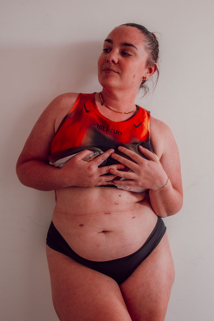 La perte de poids après une sleeve ne repose pas uniquement sur une restriction alimentaire, mais sur un ensemble de mécanismes hormonaux et métaboliques qui modifient en profondeur le fonctionnement du corps. Si les premières semaines sont marquées par une perte rapide liée à une forte diminution des apports, la suite du parcours dépend surtout de la manière dont l’organisme régule l’énergie, les hormones et le métabolisme. Comprendre ces différentes phases permet d’aborder la sleeve avec plus de recul, et surtout sans réduire cette intervention à une simple question de “manger moins”.