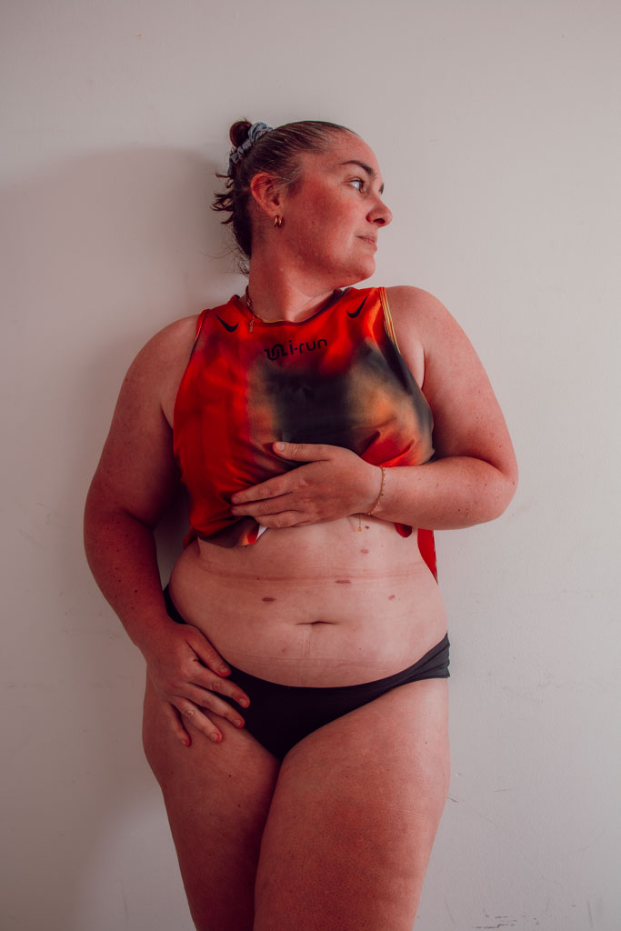 La perte de poids après une sleeve ne repose pas uniquement sur une restriction alimentaire, mais sur un ensemble de mécanismes hormonaux et métaboliques qui modifient en profondeur le fonctionnement du corps. Si les premières semaines sont marquées par une perte rapide liée à une forte diminution des apports, la suite du parcours dépend surtout de la manière dont l’organisme régule l’énergie, les hormones et le métabolisme. Comprendre ces différentes phases permet d’aborder la sleeve avec plus de recul, et surtout sans réduire cette intervention à une simple question de “manger moins”.