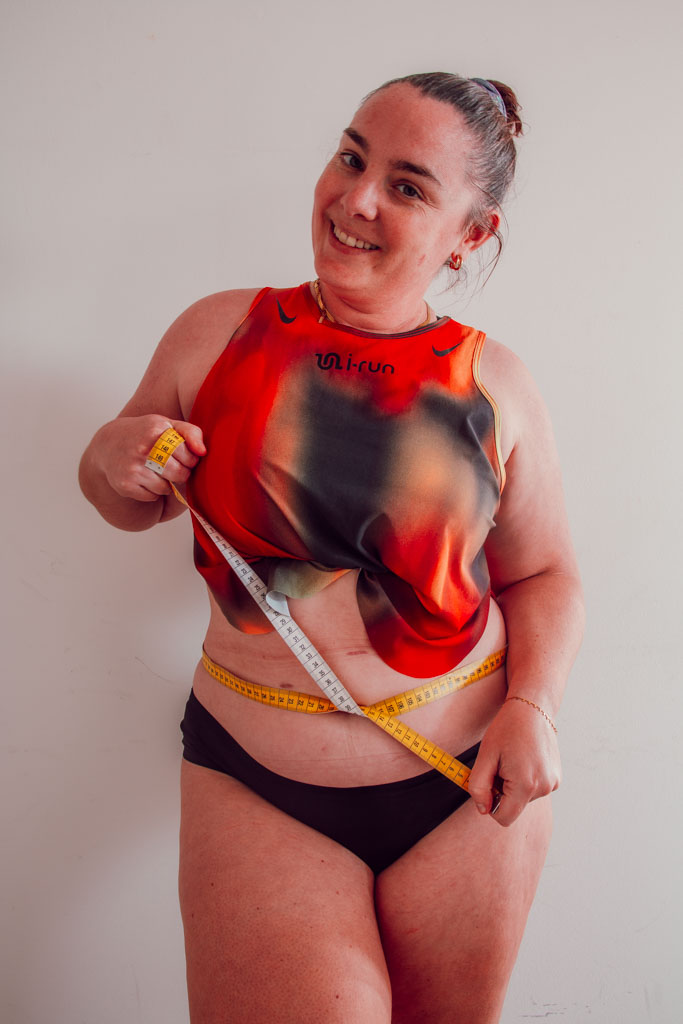 La perte de poids après une sleeve ne repose pas uniquement sur une restriction alimentaire, mais sur un ensemble de mécanismes hormonaux et métaboliques qui modifient en profondeur le fonctionnement du corps. Si les premières semaines sont marquées par une perte rapide liée à une forte diminution des apports, la suite du parcours dépend surtout de la manière dont l’organisme régule l’énergie, les hormones et le métabolisme. Comprendre ces différentes phases permet d’aborder la sleeve avec plus de recul, et surtout sans réduire cette intervention à une simple question de “manger moins”.