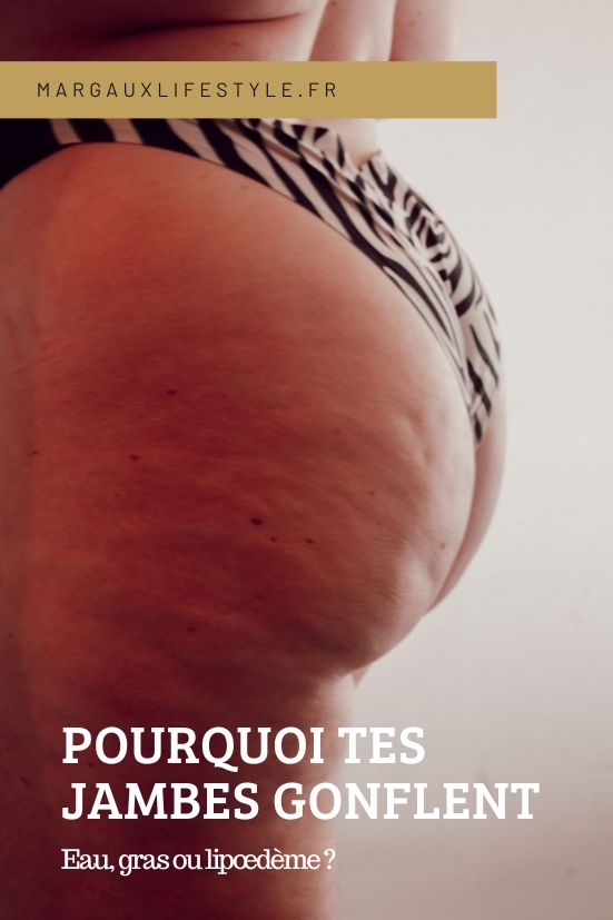 La rétention d’eau correspond à une accumulation de liquide dans les tissus, souvent temporaire et fluctuante, qui donne une sensation de gonflement au fil de la journée. La prise de gras, elle, est un stockage d’énergie progressif, généralement stable, qui modifie la silhouette sans provoquer de douleur. Le lipœdème, enfin, est une condition spécifique associée à une graisse résistante, une inflammation chronique et une rétention d’eau secondaire, ce qui le rend plus complexe à identifier et à prendre en charge.